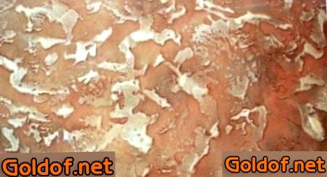 Акриловая декоративная штукатурка