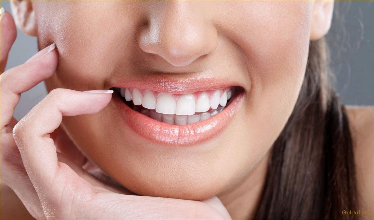 Как безопасно отбелить зубы: советы по подготовке, периодичности и поддержанию эффекта
