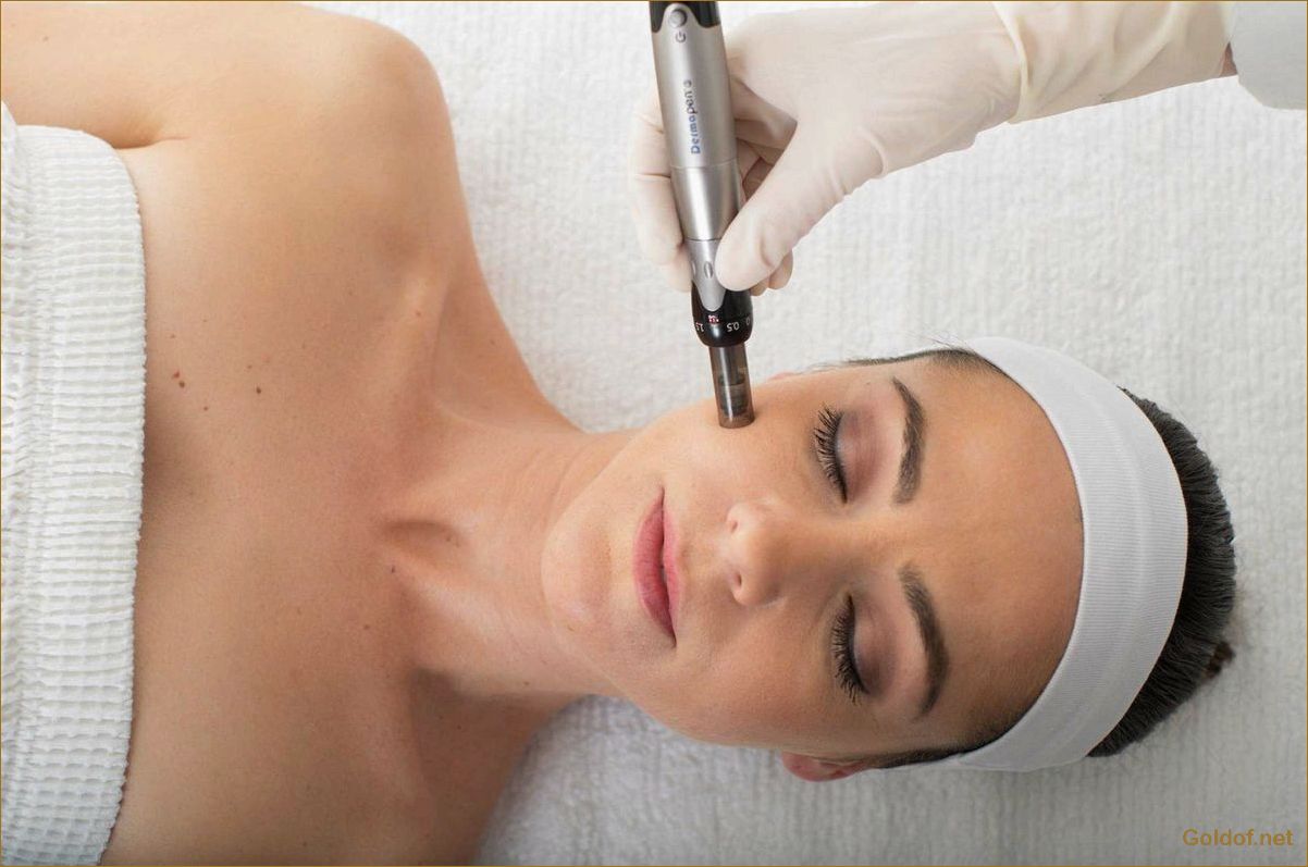 Фракционная мезотерапия: эффективный метод омоложения и улучшения кожи